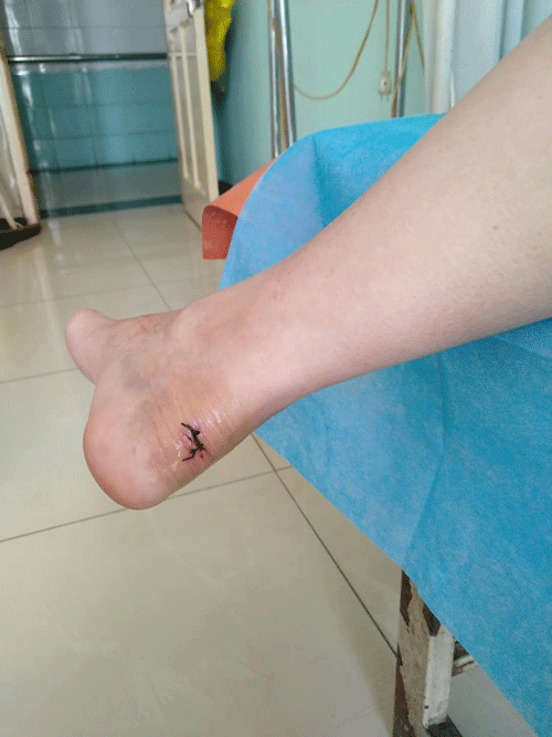 微信图片_20180626163817.gif